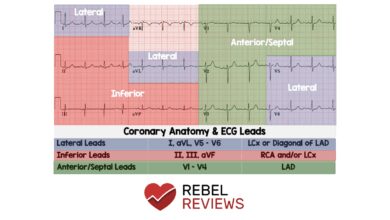 leads for ekg